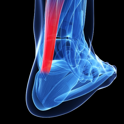 Monarch-Physiotherapy-Clinic-Calgary-AB