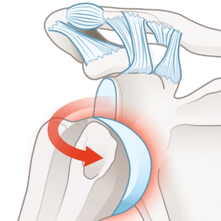 Monarch-Physiotherapy-Clinic-Calgary-AB