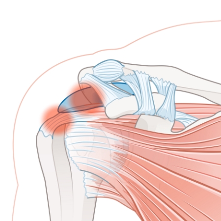 Monarch-Physiotherapy-Clinic-Calgary-AB