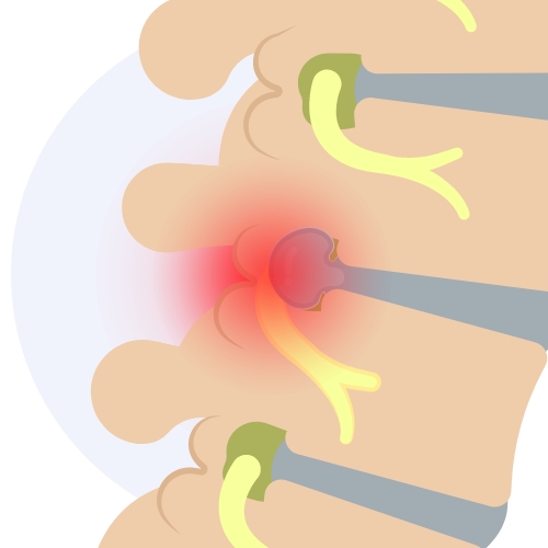 Monarch-Physiotherapy-Clinic-Calgary-AB