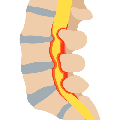 Monarch-Physiotherapy-Clinic-Calgary-AB
