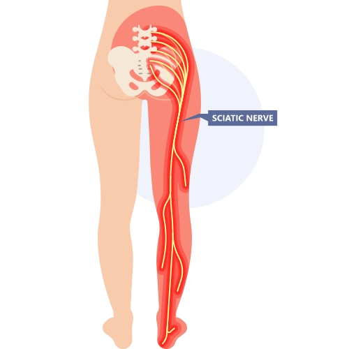 Monarch-Physiotherapy-Clinic-Calgary-AB