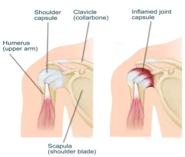 Monarch-Physiotherapy-Clinic-Calgary-AB